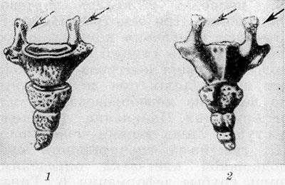 Копчик: 1 — вид спереди; 2 — вид сзади; стрелками указаны копчиковые рога.