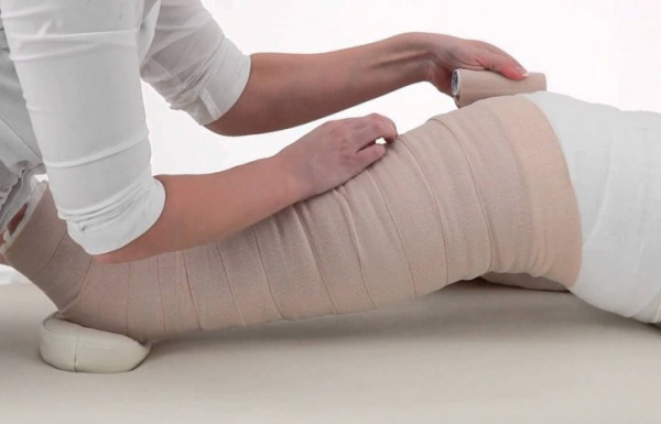 Слоновость