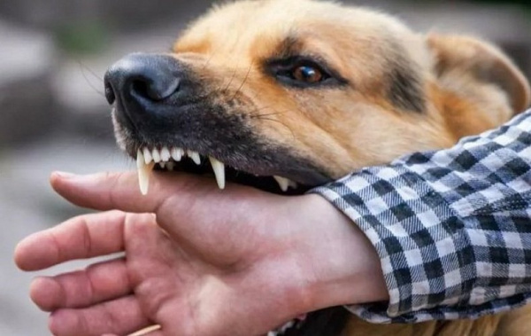 Укус собаки