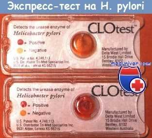 Хронический гастрит