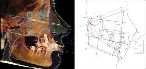 Аномалии зубной системы