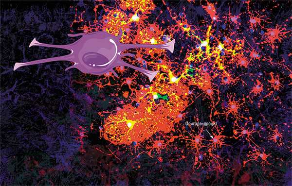 В головном мозге миелиновую оболочку создают олигодендроциты, в периферической нервной системе - клетки Шванна. Каждый олигодендроцит образует несколько «ножек», которые неоднократно «оборачиваются» вокруг части какого-нибудь аксона (внизу). В результате один олигодендроцит оказывается связан с несколькими нейронами. © Servier Medical Art. Вверху - олигодедроциты в культуре (красные, ядра - сиреневые). © jakeyoung64