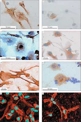 Рис. 2. Микрофотографии зрелых вакцинных дендритных клеток, нагруженных высокоиммуногенными опухолевыми антигенами («Природа» №6, 2018)