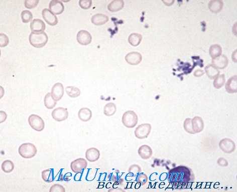 мазок крови при анемии