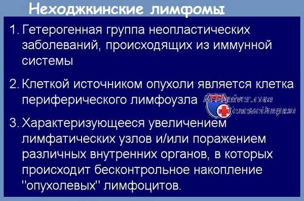 Неходжкинские лимфомы (НХЛ)