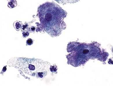 Ключевые клети