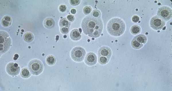 Уреаплазма