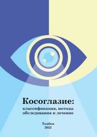 Косоглазие: классификация, методы обследования и лечение