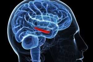 диэнцефальный криз