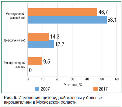 Рис. 5. Изменения щитовидной железы у больных акромегалией в Московской области