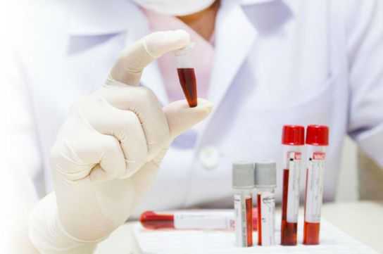 Апластическая анемия