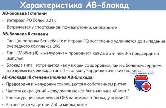 Характеристика АВ-блокад на ЭКГ