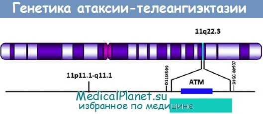 Генетика атаксии-телеангиэктазии