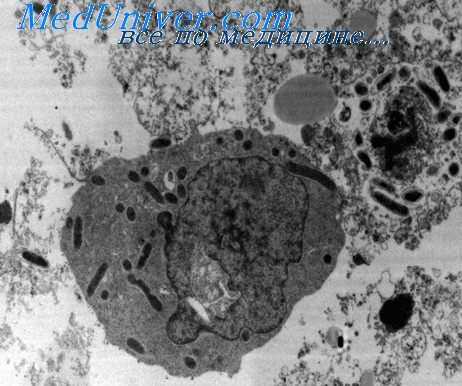 марсельская лихорадка