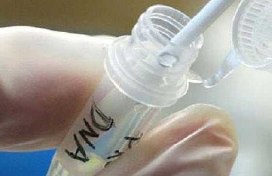  Пневмоцистоз, особенности, диагностика 