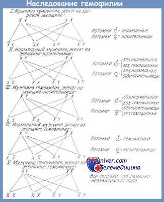 Наследование гемофилии