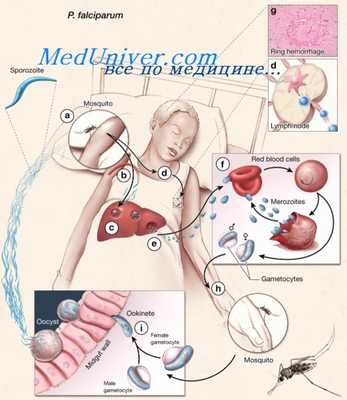 малярия