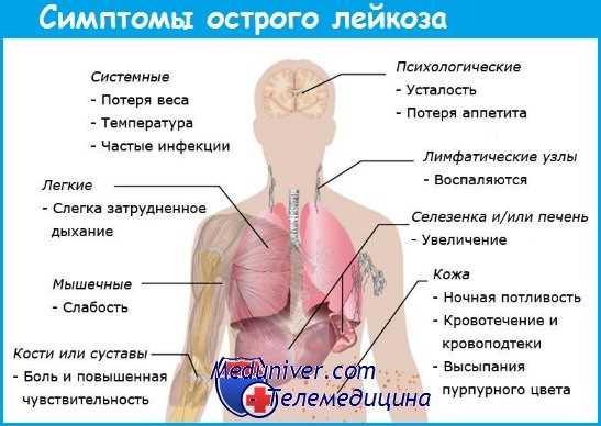 клиника острого лейкоза