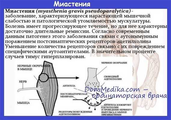 миастения