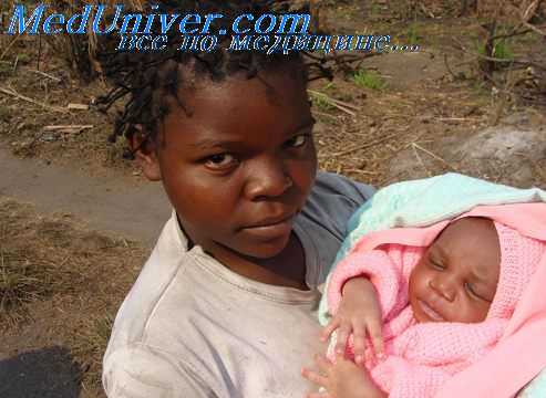 новорожденный с тетрадой фалло