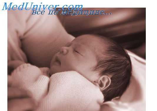 синдромы у новорожденных