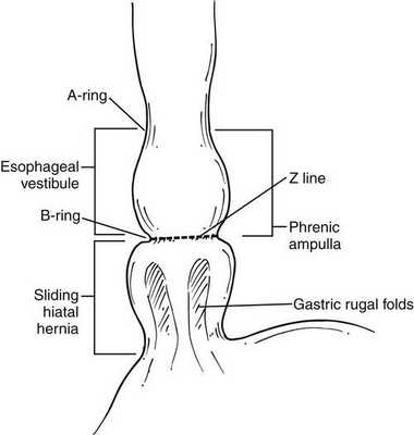Z-линия пищевода
