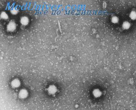 геморрагическая лихорадка