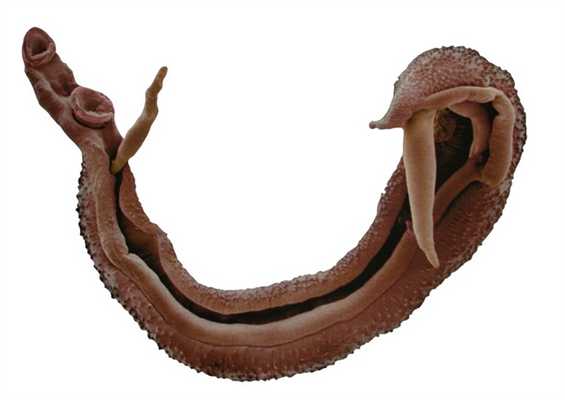 Schistosoma haematobium - трематода рода Schistosoma