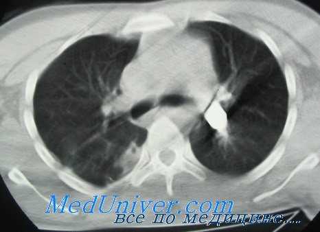 клиника травм сердца