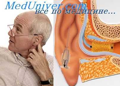 профессиональные поражения слуха