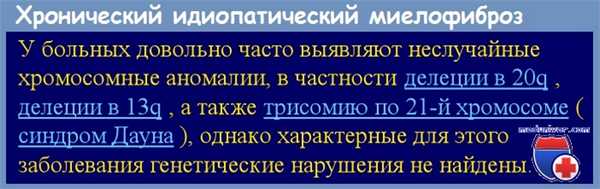 Хронический идиопатический миелофиброз (ХИМФ)