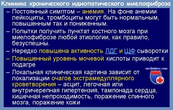 клиника хронического идиопатического миелофиброза