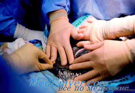 Лечение ранних послеоперационных кишечных свищей