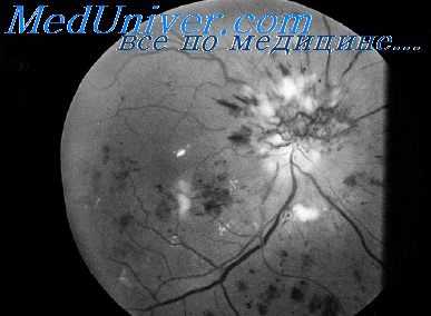 капиллярное кровообращение