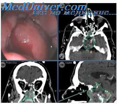 эндоскопические инструменты