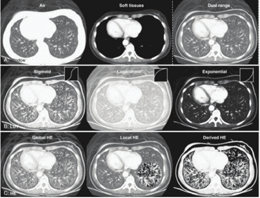 Иллюстрация применения различных компьютерных методов изменения контрастности томографического изображения