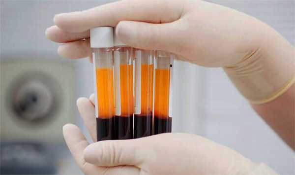 Подгоовленная для процедуры плазма крови