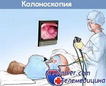 колоноскопия