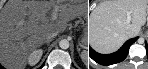 КТ внутренних органов что показывает