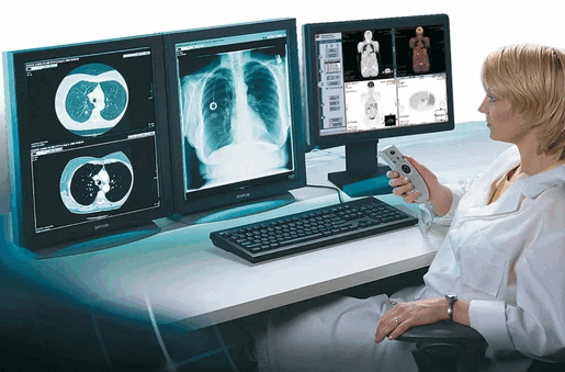 Компьютерная томография демонстрирует поликистоз почек и печени