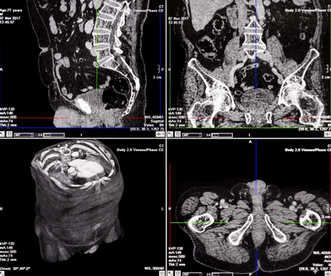 КТ внутренних органов что показывает