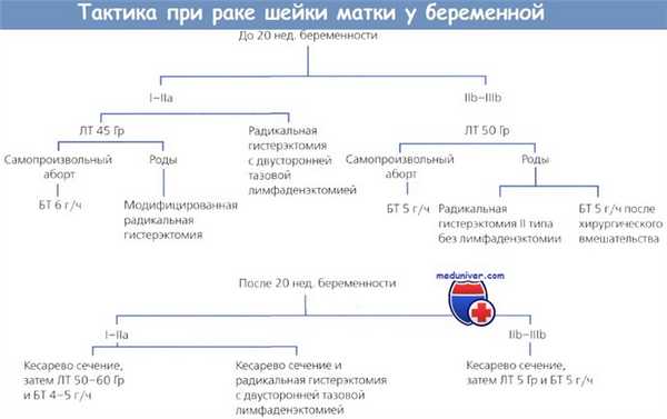 Тактика при раке шейки матки у беременной