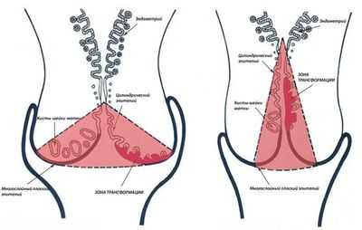 Шейка матки
