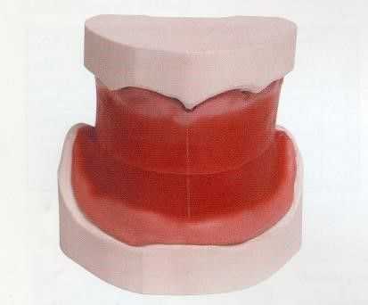 Восковые шаблоны для определения характера смыкания зубных рядов