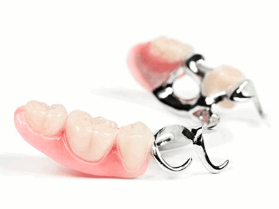 кламмерный бюгельный протез фото