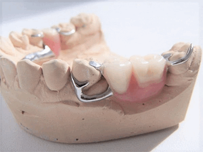 как снимать бюгельный протез фото