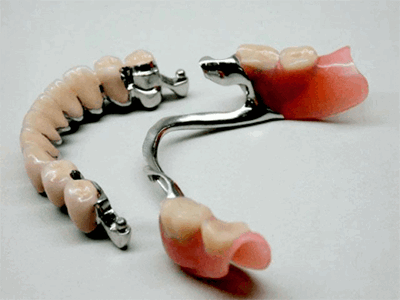 крепление бюгельных протезов фото