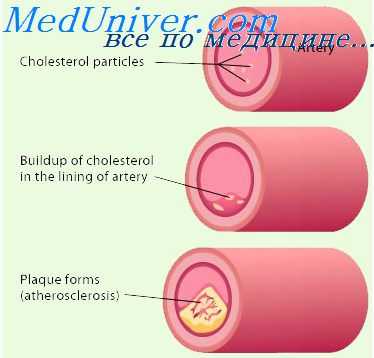 сократимость миокарда