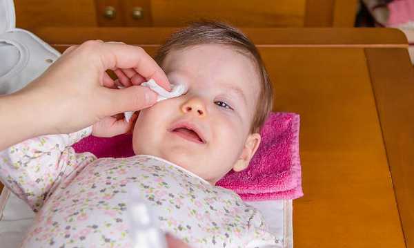 Чем лечить конъюнктивит у ребенка