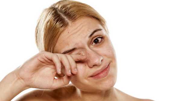 Симптомы и признаки гнойного конъюнктивита